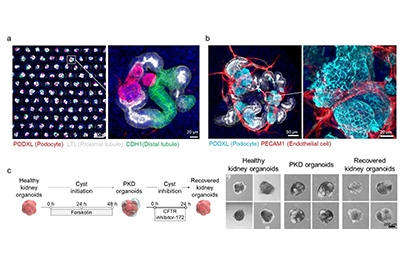 Breakthrough in Scalable Production of High-Quality Organoids 관련 이미지